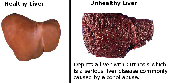 Healthy and unhealthy view of alcohol's effects.